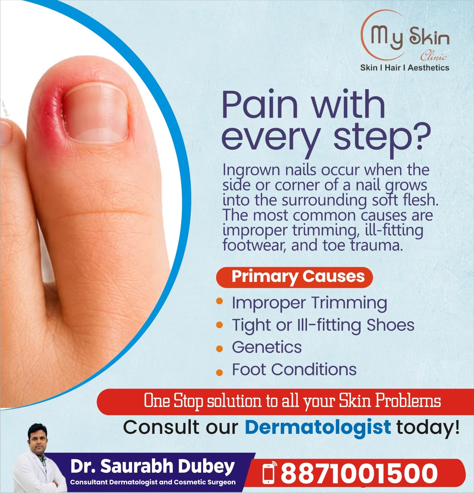 Ingrown Toenail Treatment in Indore